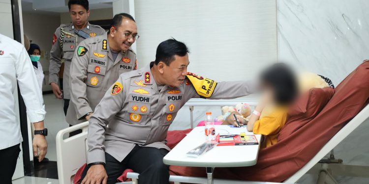 Kapolda Sulsel Kunjungi Dua Bocah Korban Penganiayaan di RS Bhayangkara