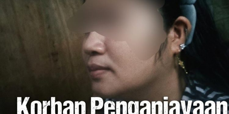 Putri Melaporkan Mantan Pacar ke Polrestabes Makassar Atas Dugaan Penganiayaan dan Penyekapan