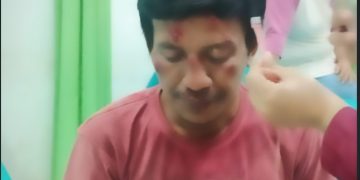 Korban Dugaan Penganiayaan Lapor, Malah Dibuatkan Surat Pengaduan